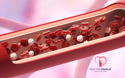 Microvascular Dysfunction in Diabetes: The New Front Line in Preventing Blindness, Kidney Failure, and Foot Amputations